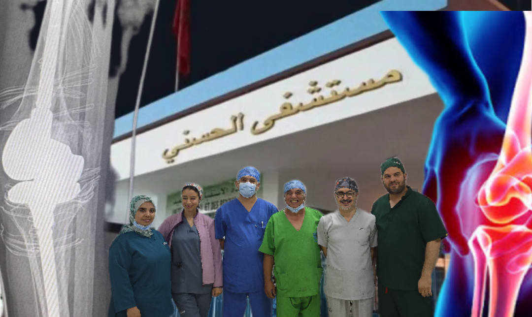 المستشفى الحسني ينجح في إجراء أول عملية لتعويض مفصل الركبة بمفصل اصطناعي كلي مقيد+ فيديو